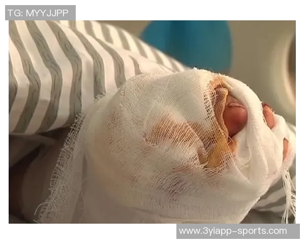 帕尔默家中意外受伤左脚小脚趾撞门引发关注 帕尔默家中意外受伤左脚小脚趾撞门引发关注